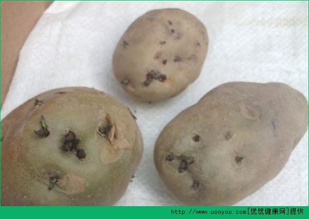 土豆和猪肝能一起吃吗？土豆和猪肝能同时吃吗？(5)
