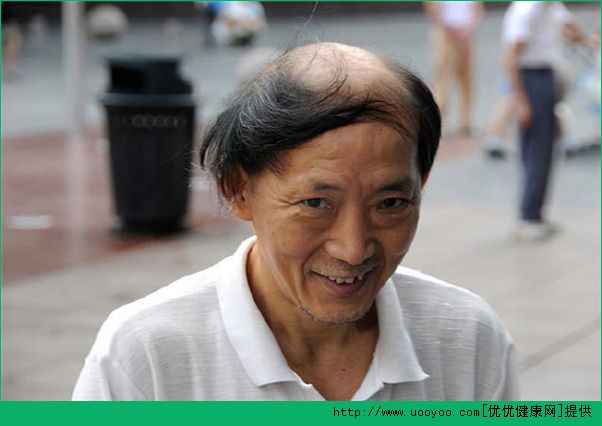 男人脱发的主要原因是什么？男人脱发怎么治疗？(1)