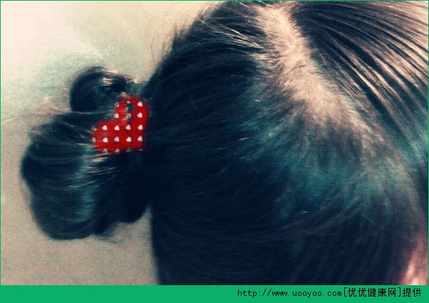 头发细软又少怎么办？亲测如何挽救又细又软的头发(4)