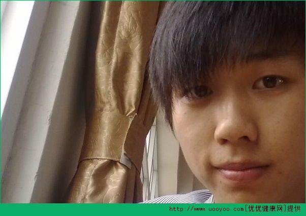 我16岁男孩为什么流汗很多？16岁流汗很多怎么办？(3)