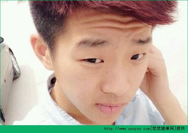 青少年如何祛除抬头纹？抬头纹消除方法？(1)