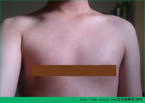 13岁男生胸大怎么办？男生胸部有硬块正常吗？[多图]