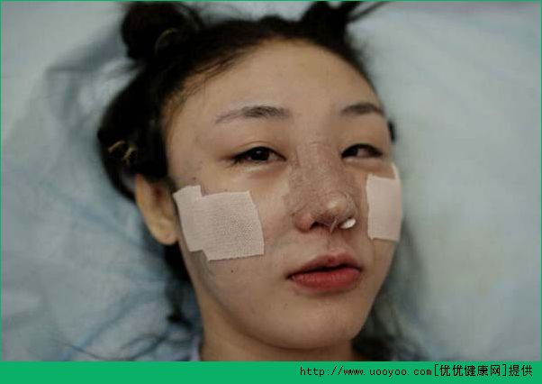 整容上瘾怎么办？整容上瘾要怎么调整心态？[多图]