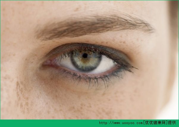 黄褐斑怎么去除？黄褐斑怎样治疗最有效？(4)