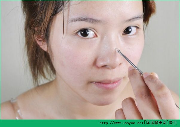 黑头是螨虫吗？黑头和螨虫的区别是什么？(5)