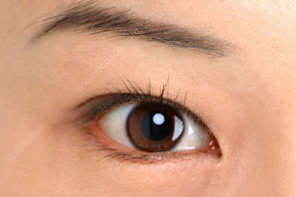 为什么睫毛老是掉？为什么睫毛老是掉到眼睛里？(4)