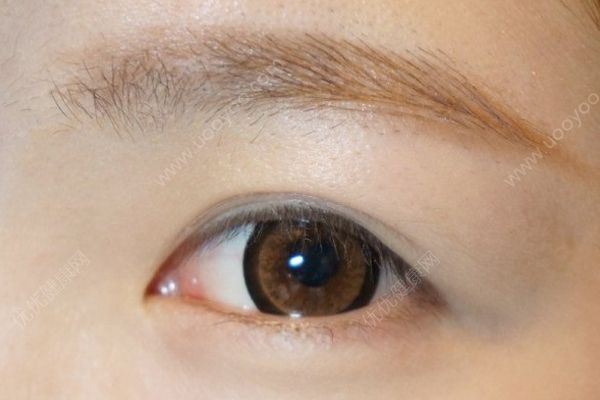 为什么睫毛老是掉？为什么睫毛老是掉到眼睛里？(1)