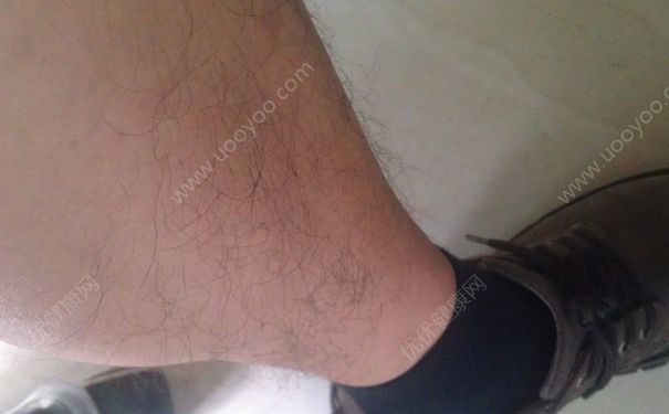 男生腿毛太密太长怎么办？男生腿毛能刮吗？(4)