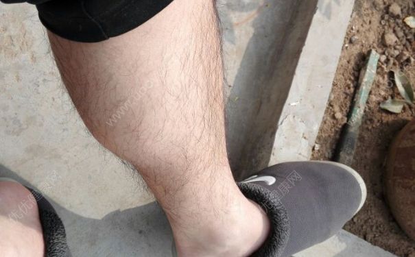 男生腿毛太密太长怎么办？男生腿毛能刮吗？(3)