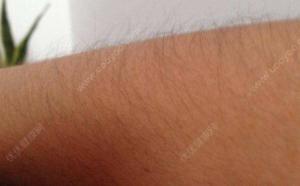 女生手臂汗毛多是怎么回事？女生手臂汗毛长怎么办？(2)