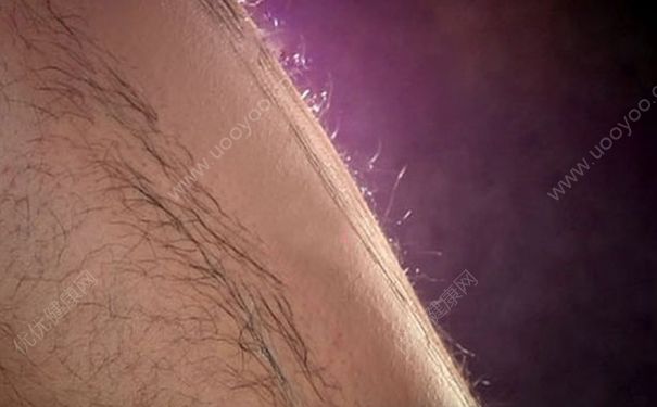 女生手臂汗毛多是怎么回事？女生手臂汗毛长怎么办？(1)