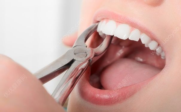备孕期间可以拔牙么？准备要小孩可以拔牙吗？(1)