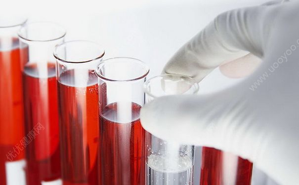 高中生能不能做妇检？高中生月经不调要做什么检查？(1)