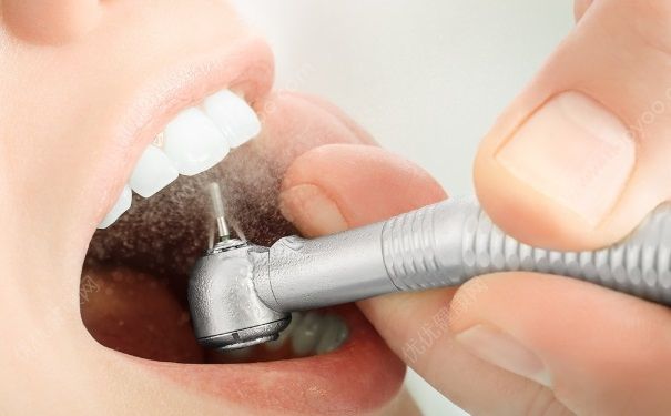 备孕期间可以拔牙么？准备要小孩可以拔牙吗？(4)
