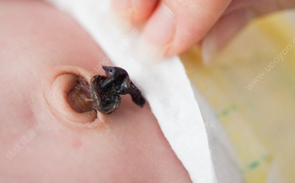 新生儿洗澡肚脐能沾水吗？新生儿洗澡要用肚脐贴吗？(4)