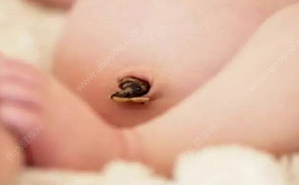 新生儿洗澡肚脐能沾水吗？新生儿洗澡要用肚脐贴吗？(2)