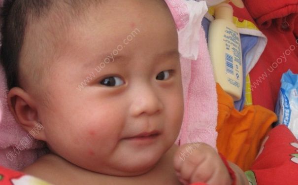 蚊子老咬宝宝怎么办？蚊子喜欢叮咬宝宝怎么解决？(2)