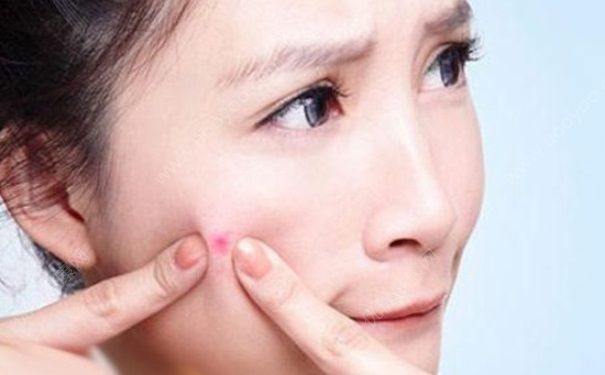 抽烟会长痘痘吗？抽烟有什么害处？(2)