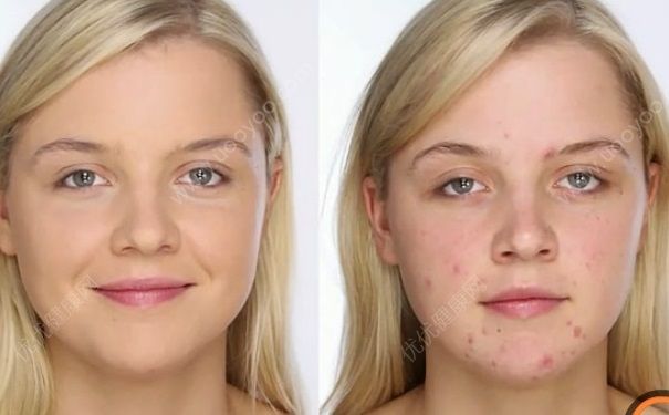 为什么要敷面膜？敷面膜的好处和坏处？(4)