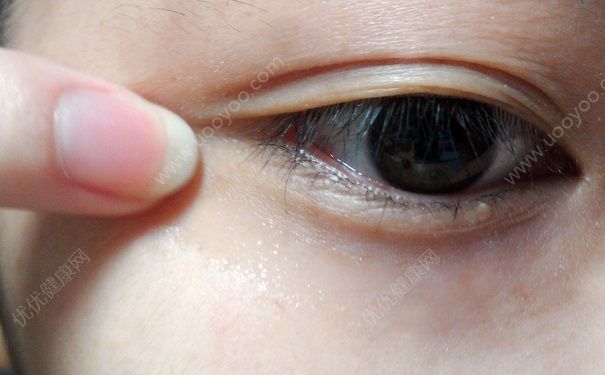 眼霜的使用顺序？眼霜的注意事项？(4)