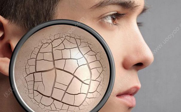 熬夜会长斑吗？熬夜对皮肤的危害(2)