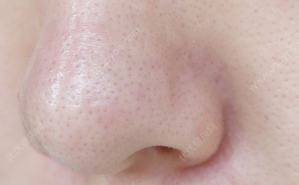 熬夜会长斑吗？熬夜对皮肤的危害(3)