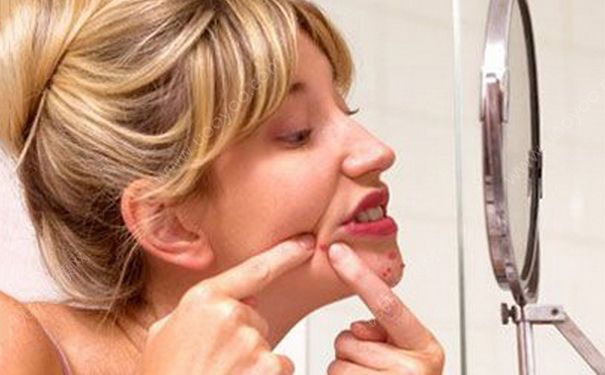 熬夜会长痘痘吗？熬夜长痘痘怎么消除？(2)