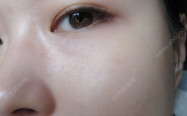 不整容怎么变漂亮？不化妆怎么变漂亮？(5)