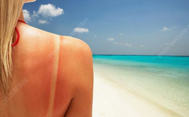 太阳晒后皮肤红怎么办？太阳晒伤皮肤怎么办？(3)