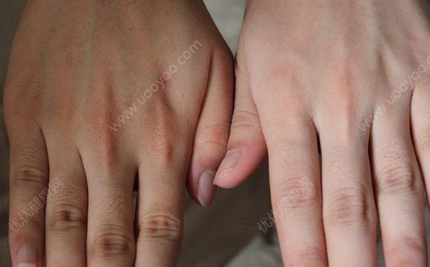 芦荟胶的功效与作用 芦荟胶的正确用法(5)