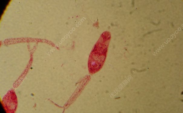 9岁男孩贫血怎么办？99岁会出现贫血症状吗？(4)