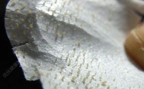 卸妆水能去黑头吗？用卸妆水可以去黑头吗？(4)