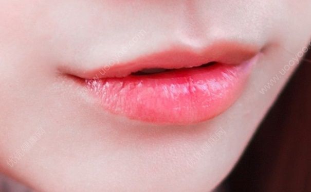 夏天嘴唇干裂是什么原因？夏天嘴唇干裂脱皮怎么办？(1)