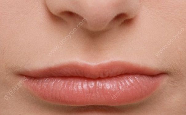 夏天嘴唇干裂是什么原因？夏天嘴唇干裂脱皮怎么办？(3)