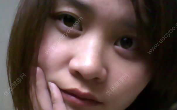 睡眠不足有眼袋怎么办？睡眠不足有黑眼圈怎么办？(2)