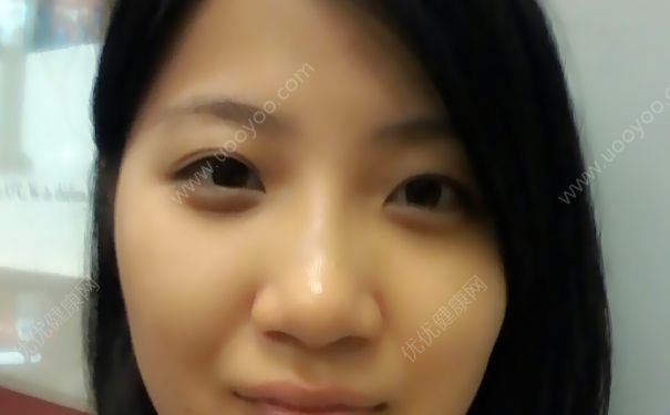 睡眠不足有眼袋怎么办？睡眠不足有黑眼圈怎么办？(3)