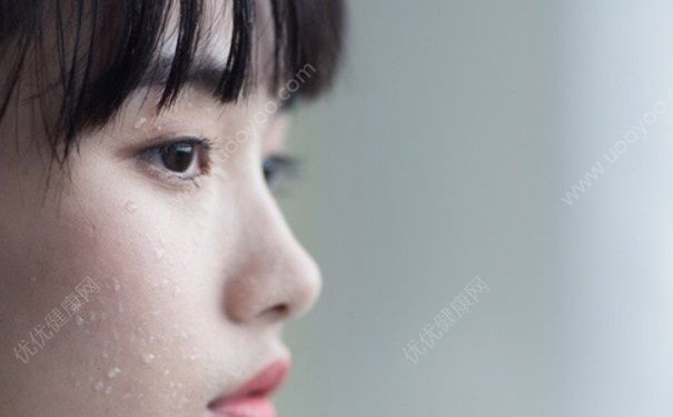 15岁长痘痘怎么办？15岁长痘痘可以用洗面奶吗？(1)