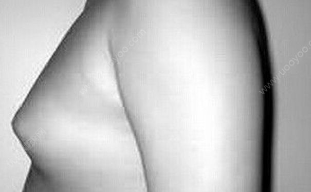 15岁男孩乳房有硬块怎么回事？15岁男孩乳头痛怎么办？(3)