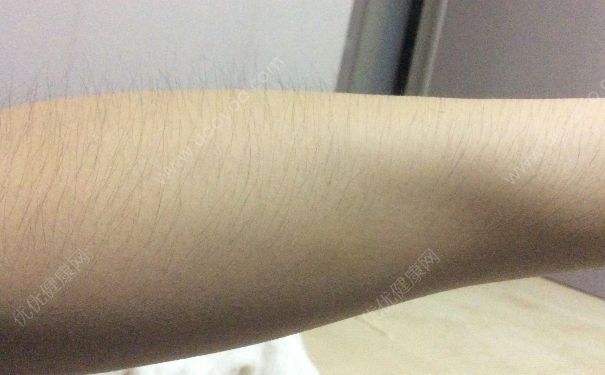 17岁男生体毛长怎么办？男生体毛过多怎么回事？(4)