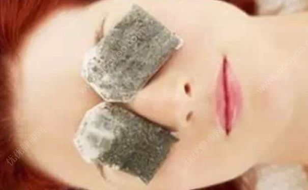 黑眼圈能做手术吗？光子嫩肤能去黑眼圈吗？(6)