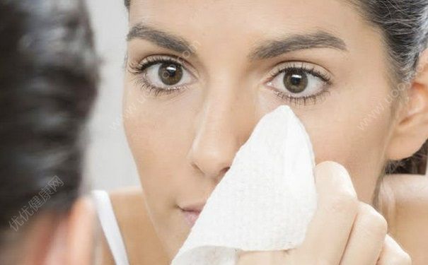 闭口粉刺是什么？闭口粉刺怎么去除？(4)