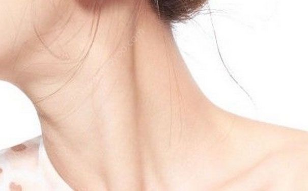 如何按摩去颈纹？去颈纹最有效的方法(9)