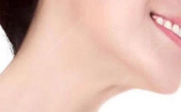 如何按摩去颈纹？去颈纹最有效的方法(5)