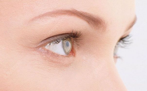 怎么预防眼部皱纹？眼部肌肤怎么保养？(1)