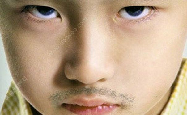 孩子性早熟的原因有哪些？孩子为什么会性早熟？(6)