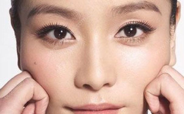 如何快速消除眼袋？快速消除眼袋的小窍门(1)