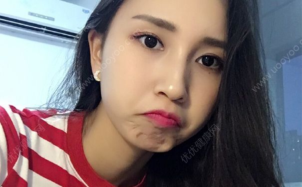 BB霜会伤害皮肤吗？BB霜用多了会伤害皮肤？(4)