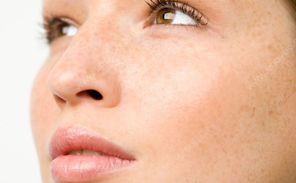 雀斑是显性遗传吗？先天性雀斑能治好吗？(3)