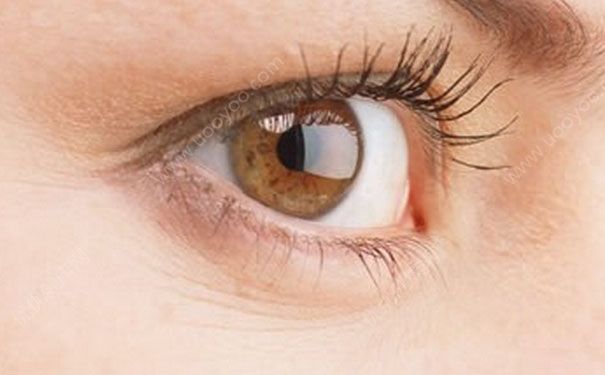 如何去除鱼尾纹？鱼尾纹怎么消除？[多图]