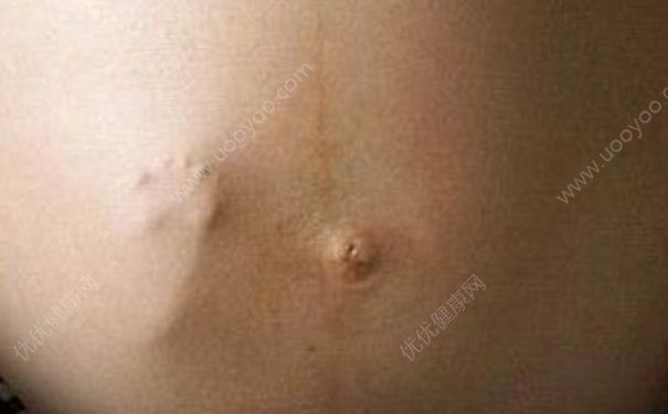 胎动什么时候开始？胎动频繁是什么原因？(1)